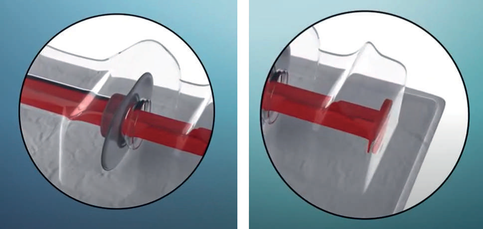 Sterilization by VHP | Considerations for Pre-Filled Syringe Applications